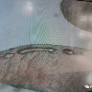 �����|Ѫ�]�����μ��g(sh��)̽ӑ